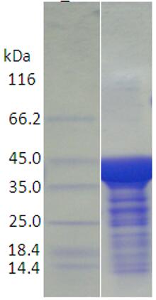 15% SDS-PAGE analysis profiles of purified AB57_3396-306-691 (CBB stained).